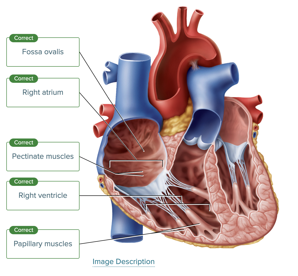<p>fossa ovalis- shallow depression in wall between the two atria</p><p>pectinate muscles- comb-like muscular ridges inside the atrial wall</p><p>papillary muscles- finger-like projections that anchor the chordae tendineae.</p>