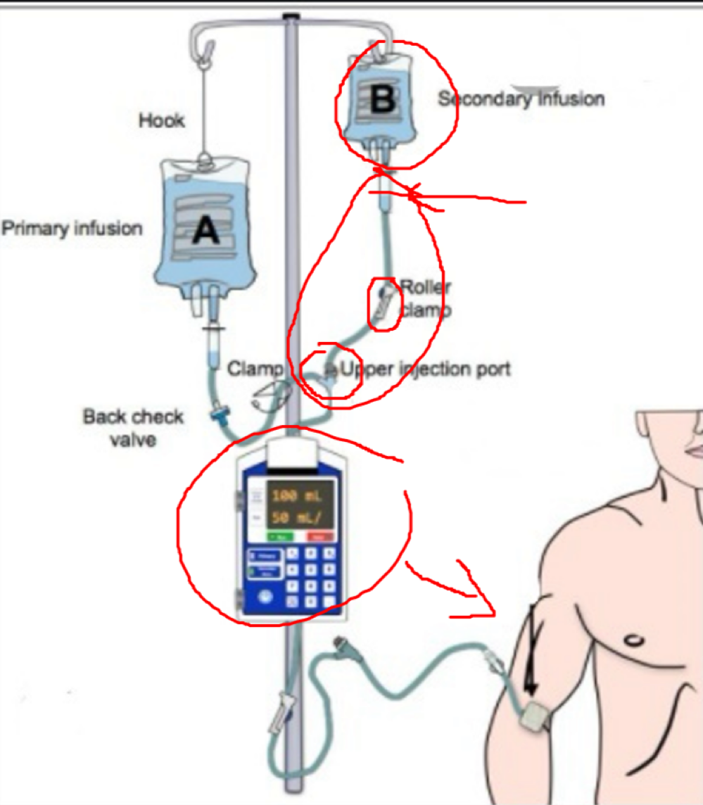 <ul><li><p>secondary infusion above primary</p></li><li><p>roller clamp</p></li><li><p>upper injection port</p></li><li><p>IV pump</p></li></ul><p></p>