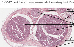 <p>What is indicated by the arrows labeled 'A' in this slide of peripheral nerve?</p>