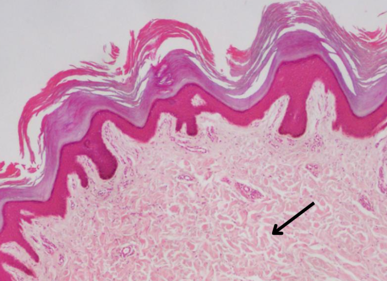 <p>which part of the dermis is this</p>