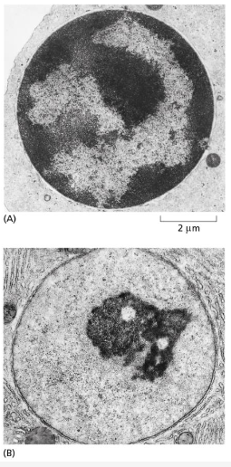 <p>which cell is transcribing more of its genes and why?</p>