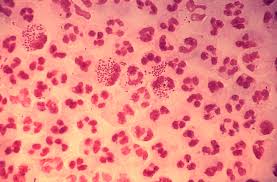 <p>gram - diplococcus</p>