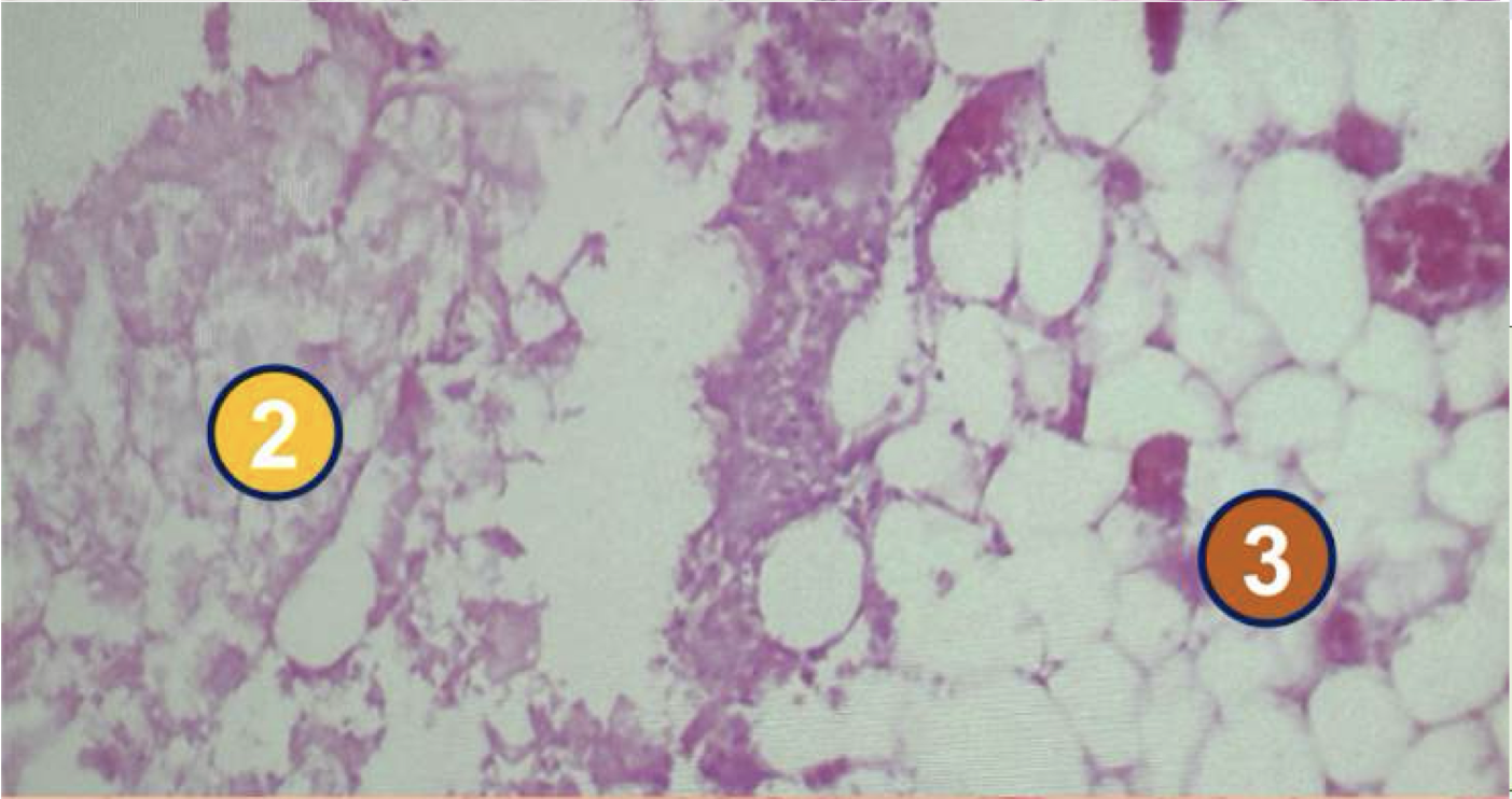 <p>Diagnose and identify pointed structure</p>