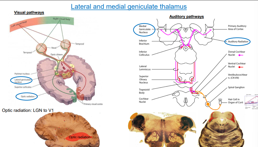 <p>• Lateral Geniculate (LGN) </p><p>➢ Input from optic tract (from retina) </p><p>➢ Outputs to primary visual cortex (via optic radiation) •</p><p> Medial Geniculate (MGN) </p><p>➢ Input from inferior brachium (from ……cochlear) ➢ Output to primary auditory area (via auditory radiation)</p>