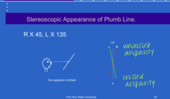 <p>Stereoscopic Appearance of Plumb Line (Pic)</p>