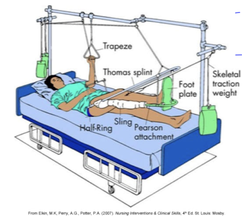 <p>skeletal traction- for? action? result?</p>