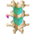 <p>Ligamentum flavum and its restriction? </p>