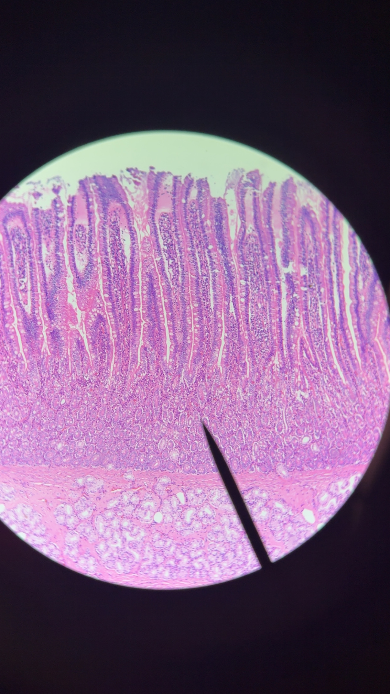<p>duodenum features - 4 </p>