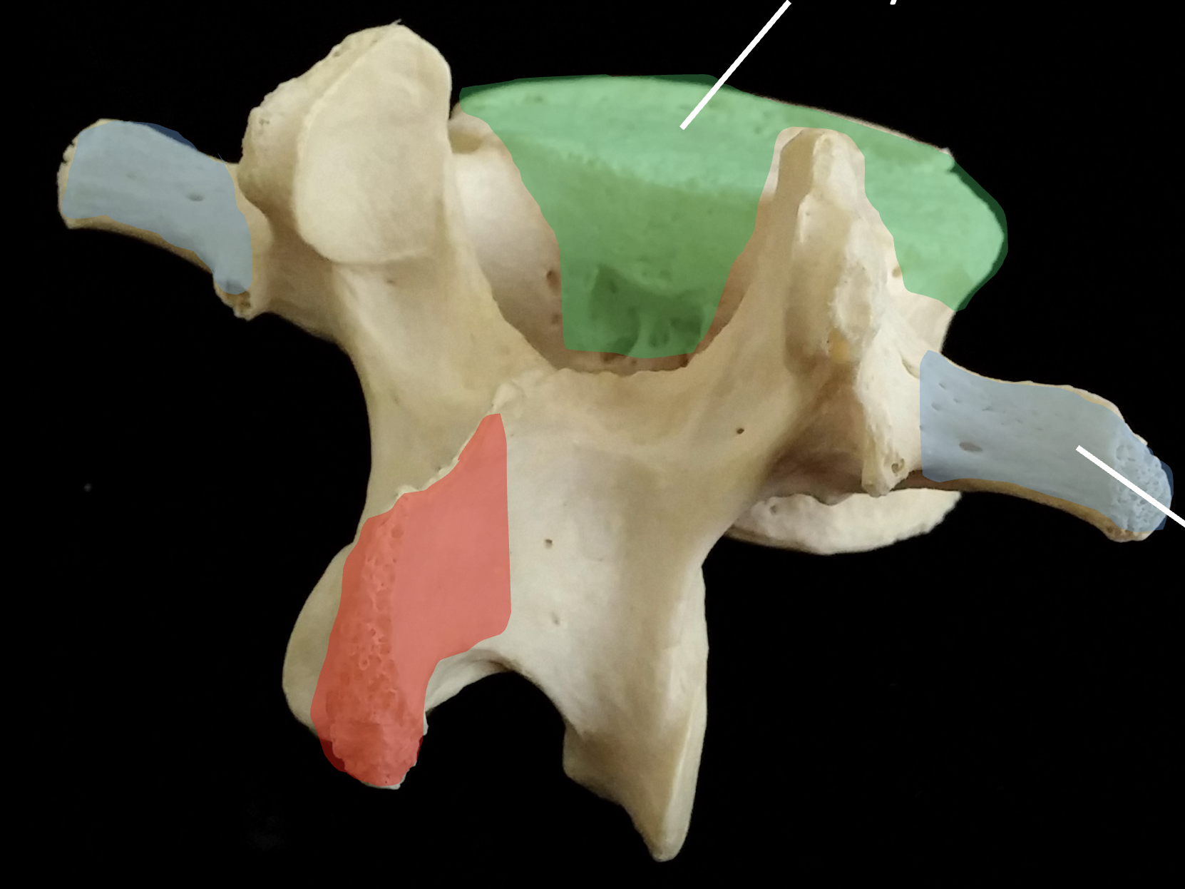 <p>What is the red region highlighted on the lumbar vertebrae?</p>