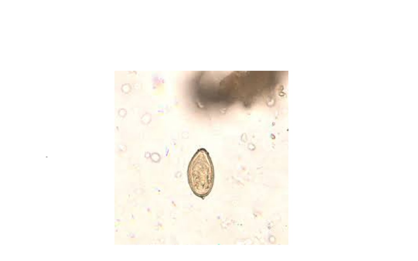 <p>Identify the following fluke egg</p>