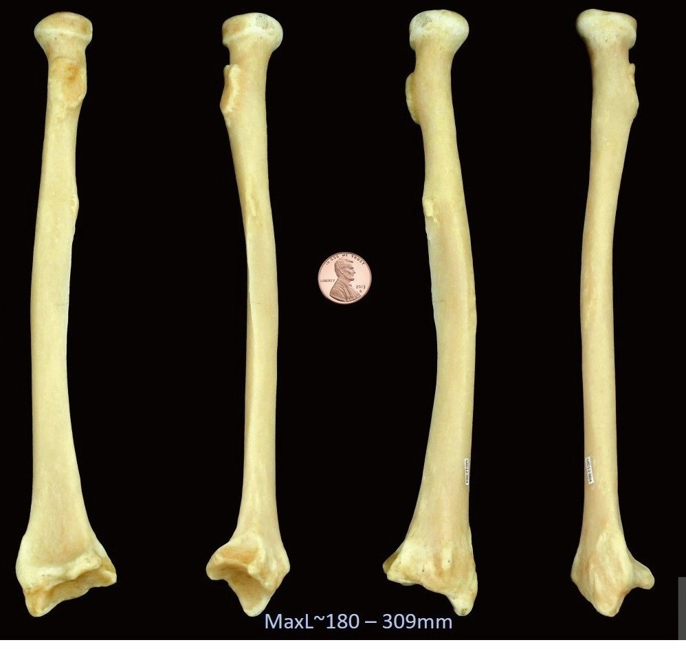 <p>name and side this bone</p>