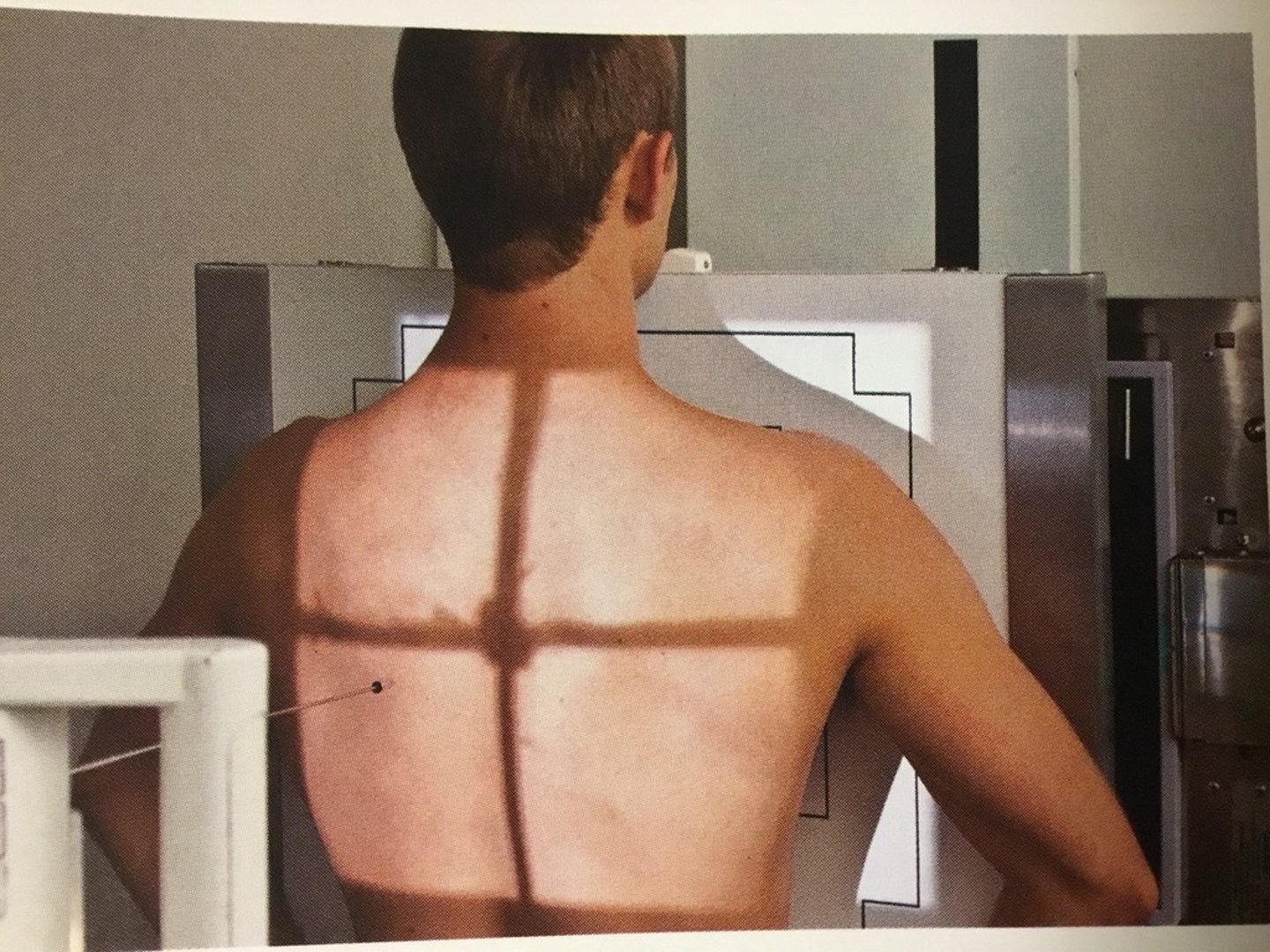 <p>- What exam is this?</p><p>- What is the SID?</p><p>- Is the patient shielded?</p><p>- How is the patient positioned?</p><p>- What projection is used if the patient's pain is in the front?</p><p>- What projection is used if the patient's pain is in the back?</p><p>- What do you mark the affected area with?</p>