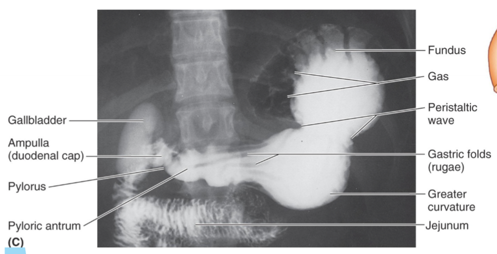 knowt flashcard image