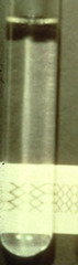 <p>Describe this joint fluid</p>