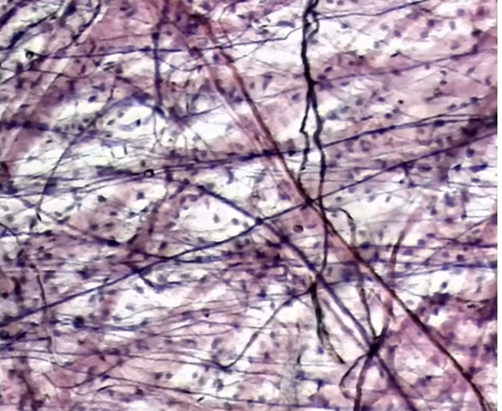 <p>Areolar tissue (function) </p>