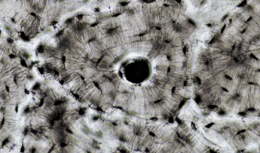 <p>Cortical Bone</p>