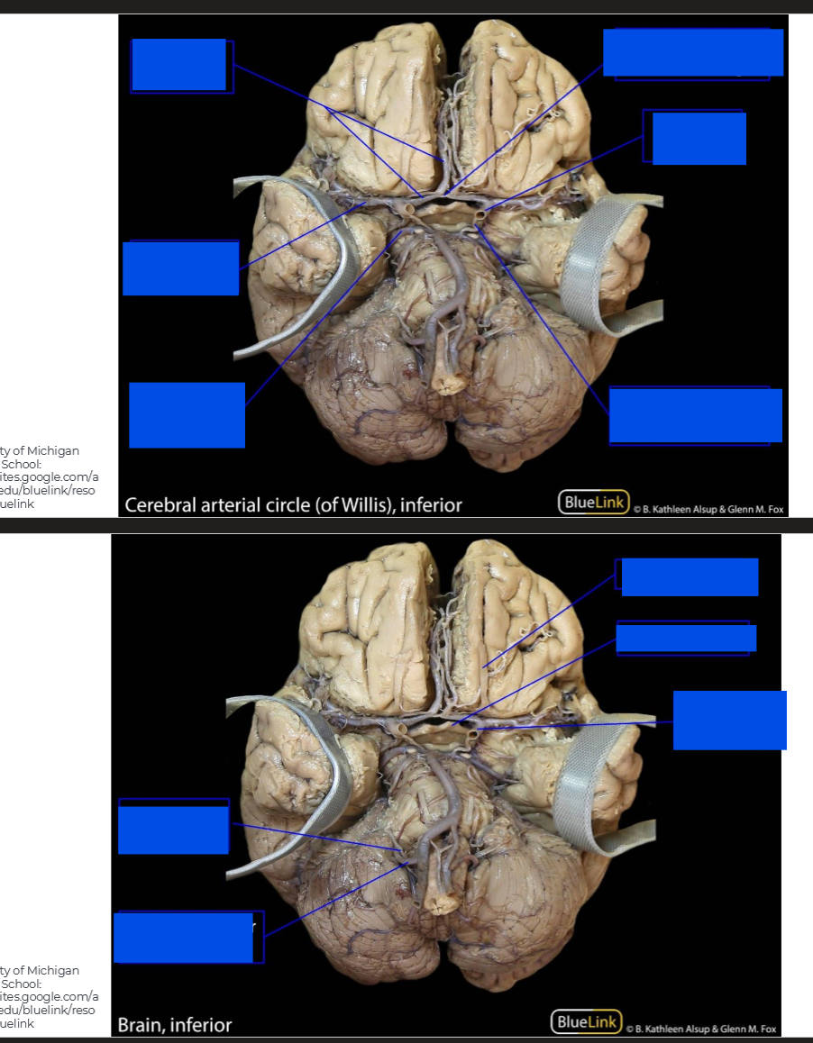 <p>Label the brain</p>