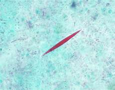 <p>Parasite or Artifact? Identify.</p>