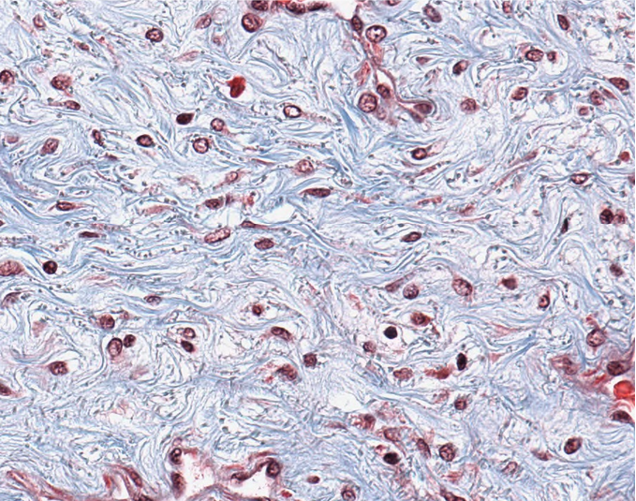 <p><span style="font-family: "Calibri Light";">Which type of CT is this?</span></p>