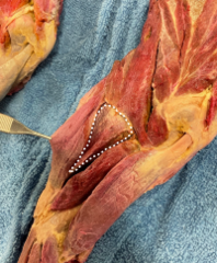 <p>Identify the muscle</p>
