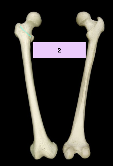 <p>what is 2?</p>