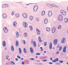<p>Protection and added distensibility </p><p>EX: urinary bladder and ureters</p>