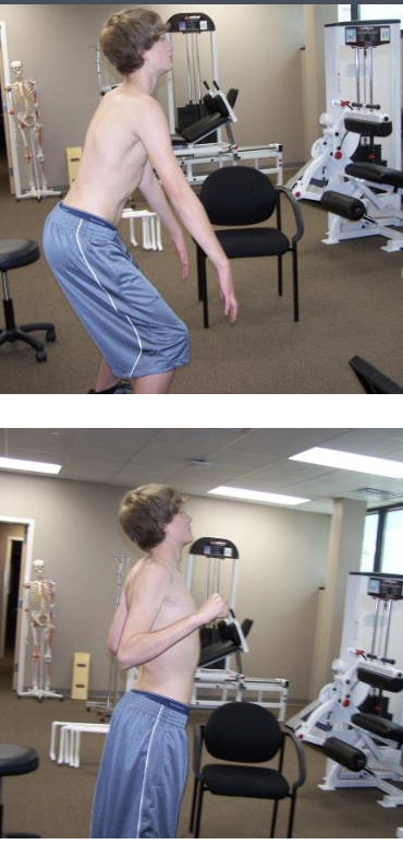 <p>The patient begins in a standing position with the trunk flexed to approximately 40° to 50° with arms forward flexed and palms facing the thighs. While keeping the elbows close to the body, each subject moved into trunk and arm extension and flexed the elbows so palms were facing up and away from the body while simultaneously pinching both scapulae toward his or her back pockets with a strong 5- second contraction.</p><p>Note: Good coordination of 3 upward rotators</p>