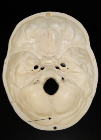 <p>What is this bone?</p>