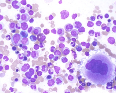 <p>Which of the following descriptors would apply to the bone marrow image?</p>