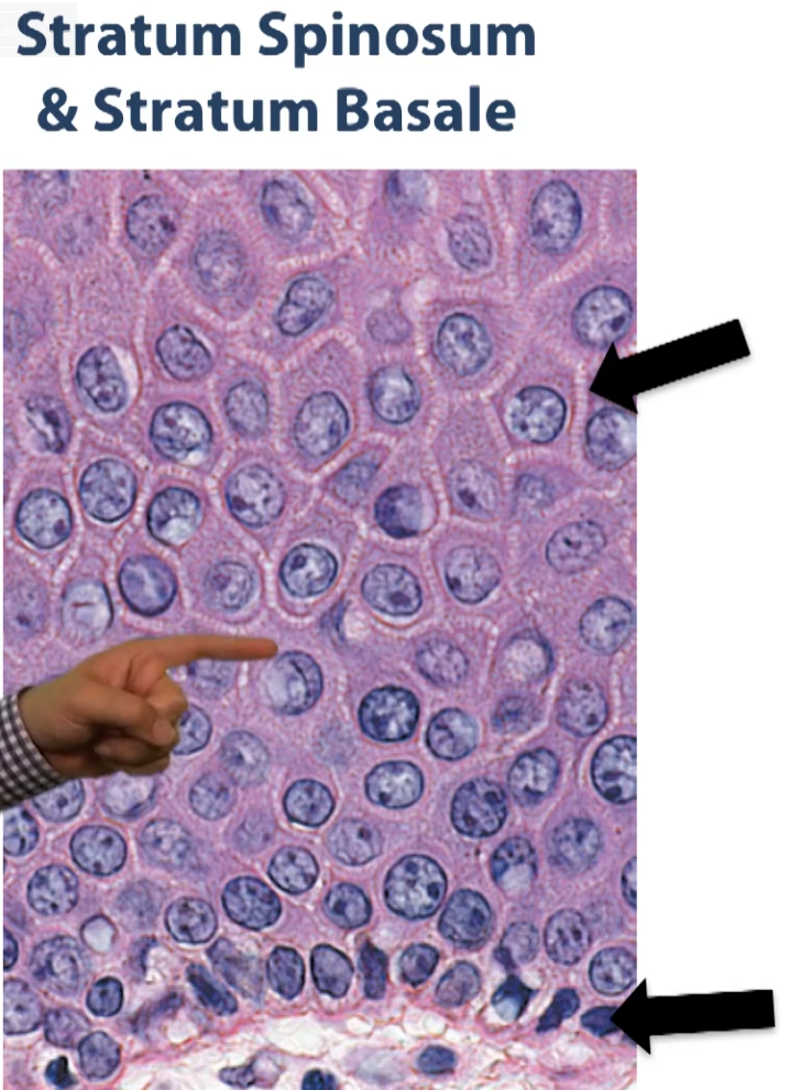 <p>Below the stratus granulosum, we have a layer of cells called the <strong>spinous layer</strong>. Notice that from the side of each of these cells you see this tiny little spiny processes coming out. What you are seeing here is cytoplasmic extensions from these cells that are contacting similar extensions from neighboring cells, and they are being bound together. They are joining at these spiny processes to one another by way of desmosomes, and they are using the protein keratin to bind adjacent cells to one another. </p><p>Then the empty spaces where you see here, where there’s white, what happens is, some of that material, some of those lipids that are being exocytosed by the stratus granulosum, they drip (they not only form a barrier above the granulosum) but they also drip in between these cells and they fill the spaces in-between these cells to provide an extra barrier against moisture loss or moisture gain in our epidermis. </p>