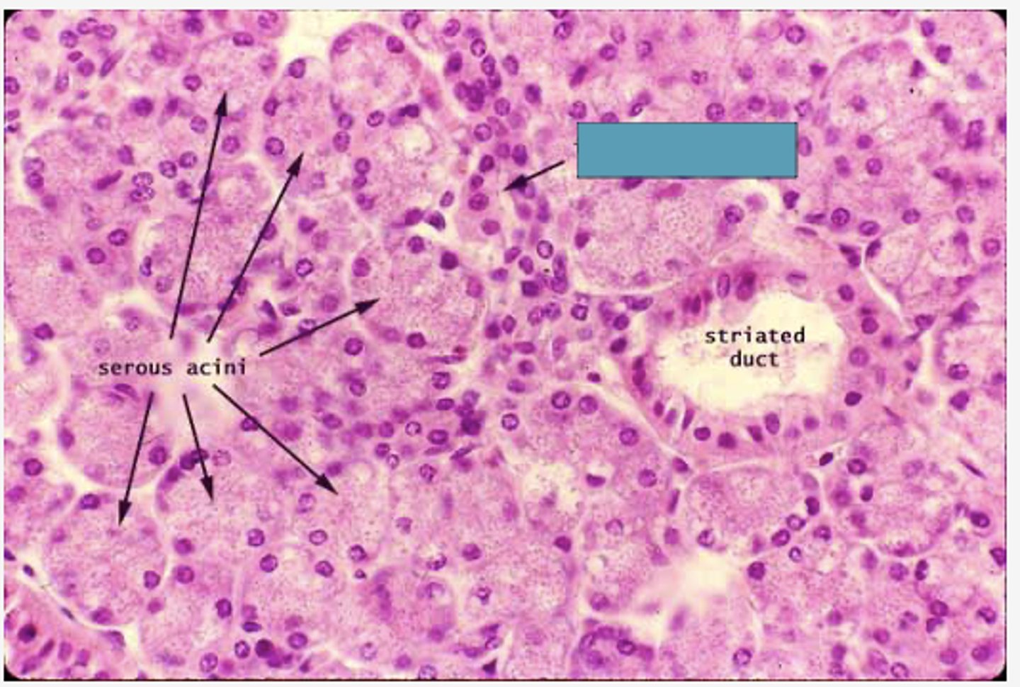 <p>Identify the following structure</p>