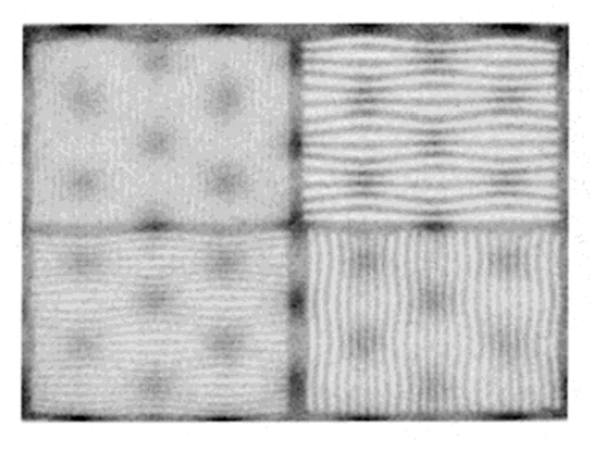 <p>What artifacts are seen in this image?</p>