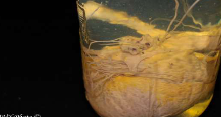 <p><strong>Phylum:</strong> Nematoda</p><p>Heartworm in dog</p>