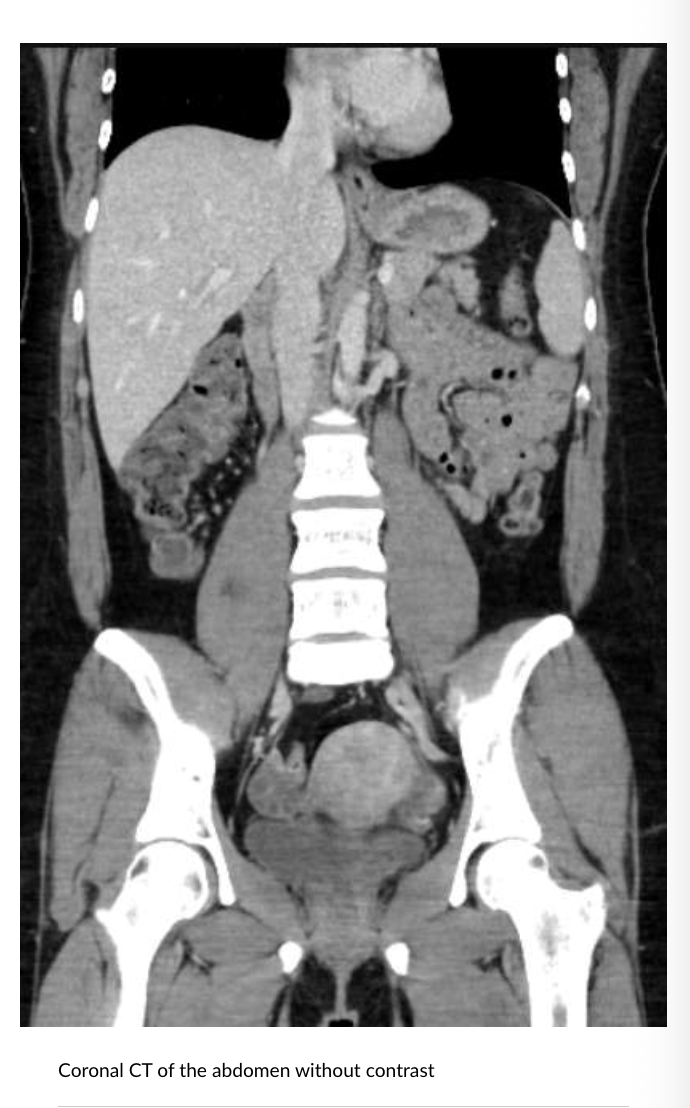 <p>Air: Black Bone: VIOLENT white Soft Tissue: Grey</p>
