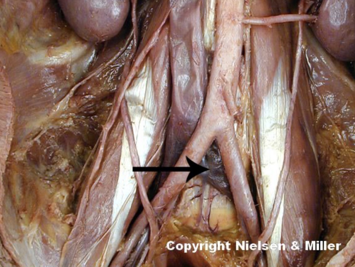 <p>The indicated vessel is the left _. The indicated vessel, together with the corresponding vessel on the right side, drain the _, external genitals, and the _</p>