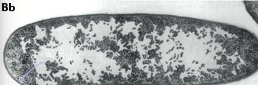 <p>What is being stained in this cell?</p>
