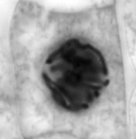 <p>what is this plant cell going through? - mitosis </p>