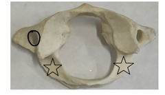 <p>what is marked? (not the star)</p>