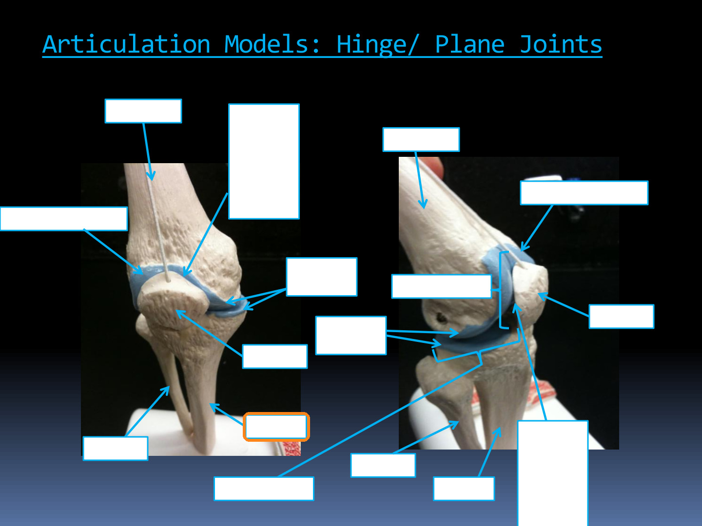 <p>Identify the highlighted structure in the Knee Articulation Models diagram.</p>