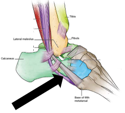 <p>One tendon passes superior to the landmark circled above in Question #7, and one tendon passes inferior to this landmark. Which tendon, pointed to by the arrow in the following picture, passes inferior to this landmark:</p>