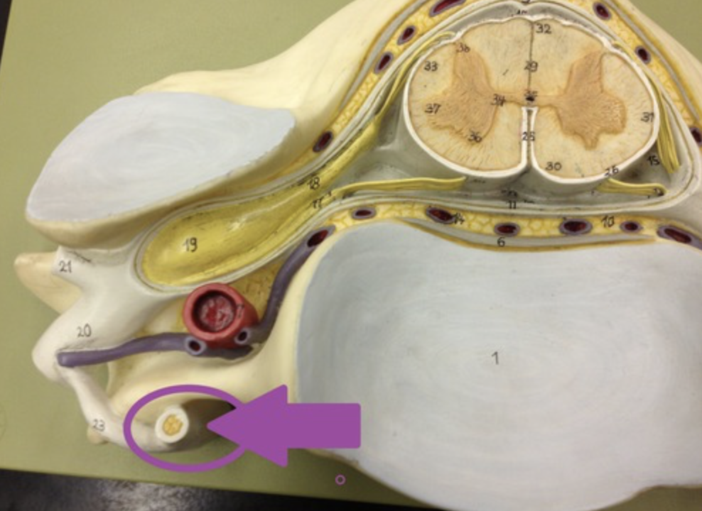 <p>contain cell bodies of sympathetic post- ganglionic neurons</p>