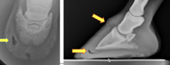 <p>How does a subsolar abscess lead to such severe pain?</p>