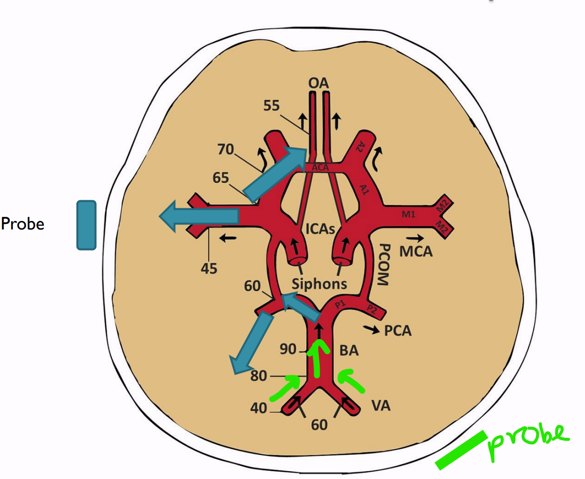 <p><span style="background-color: transparent;"><span>Away from the probe</span></span></p>