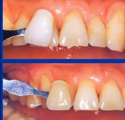 <p>What is the value and chroma of both of these shade matches?</p>