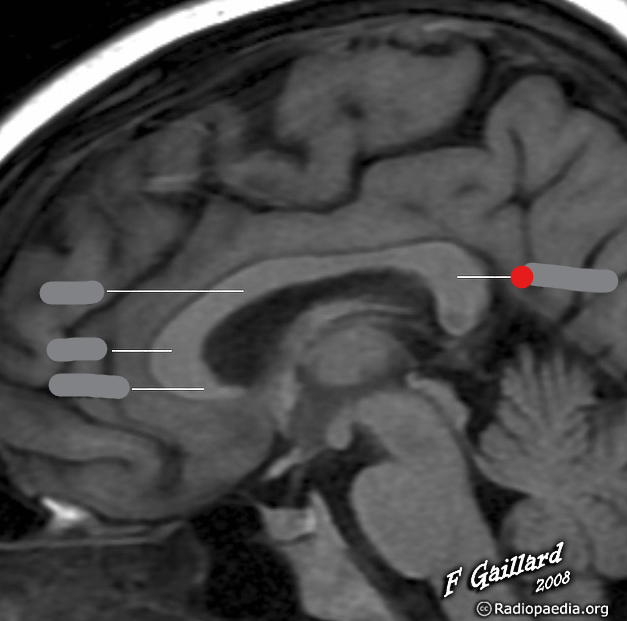 <p>Identify the structure pinned</p>