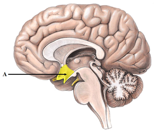term image