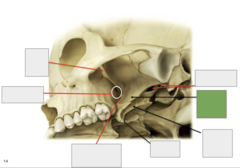 <p>Inferolateral view: This is the</p>