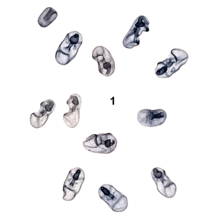 <p>What larval stage is this?</p>