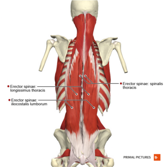 <p><strong>Origin</strong>= lumbar inferior thoracic aponeurosis (thick band of CT instead of aponeurosis</p><p><strong>insertion</strong> (3 parts)</p><p>Spinalis= superior thoracic </p><p>Longissimus = C2-6 Mastoid process</p><p>Iliocostalis= Ribs</p><p><strong>Actions=</strong> spine extension, lateral bending of spine this is specific to the area of pull</p><p></p>