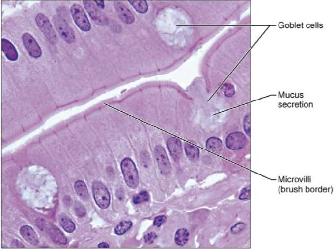 <ul><li><p>location: lines most of digestive tract, gallbladder, small bronchi, uterine tubes, and some parts of the uterus. </p></li><li><p>function: absorption, secretion of mucus.</p></li></ul><p></p>